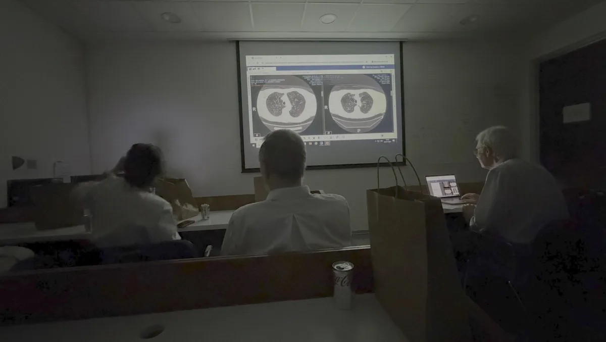 Reunión del comité multidisciplinario de nódulos pulmonares: los participantes revisan un TAC de tórax proyectado en la pantalla